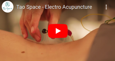 ElectroAcupuncture1